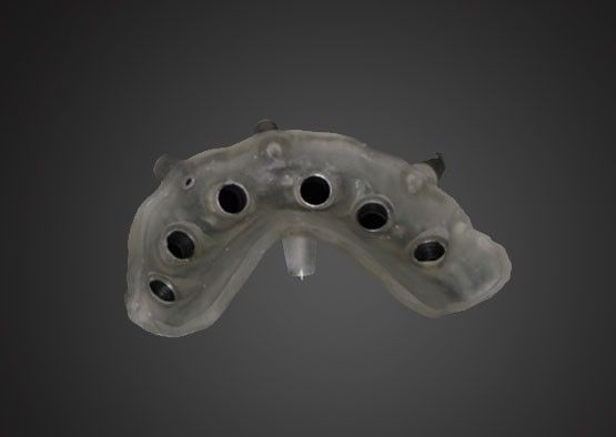 comprar Plan quirúrgico para el diseño de la corona con apoyo de implantes e información de los huesos alveolares Fabricación en línea