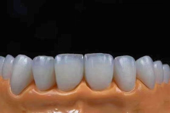 comprar Coronas de zirconia de alta transparencia y estética, perfectas para el aspecto natural Fabricación en línea