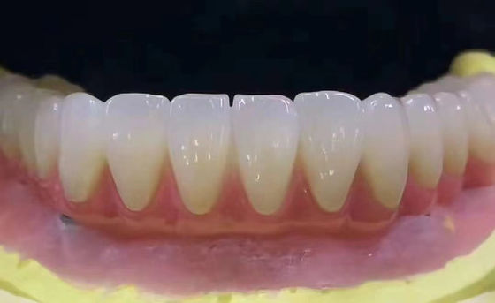 comprar Coronas dentales de zirconia personalizadas resistentes a las manchas con alta precisión Fabricación en línea