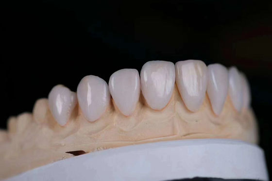 comprar Corona de cerámica de zirconia de múltiples capas de larga duración ajustable con certificación FDA Fabricación en línea