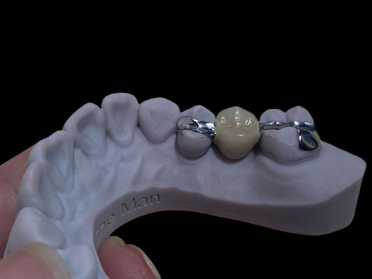 comprar Dental de puente de Maryland de larga duración y blanco, personalizable para la restauración. Fabricación en línea