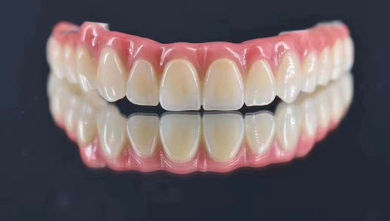 comprar Laboratorio Dental Implante personalizado coronado de metal natural con soporte buscando estabilidad a largo plazo Fabricación en línea