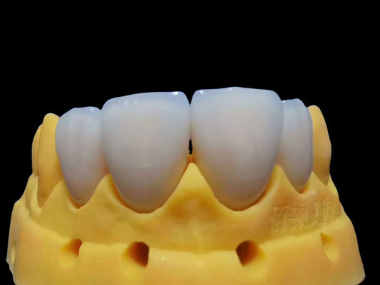 comprar Coroneta de zircónia ajustable, personalizada y segura de usar Fabricación en línea