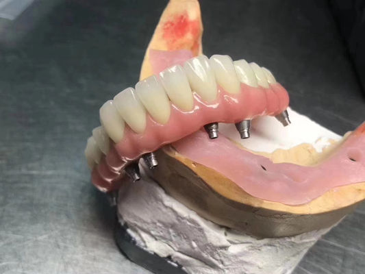 comprar Implante sólido de alta translucidez con corona de apoyo personalizable para la restauración dental Fabricación en línea