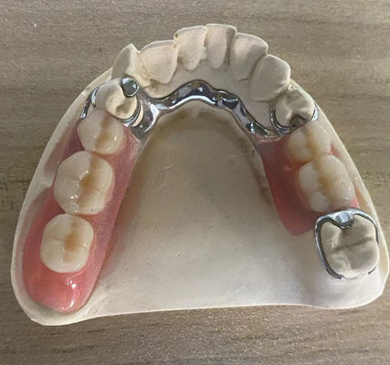 comprar Dentura de marco de metal de plata confiable resistencia a la corrosión con diseño personalizable Fabricación en línea