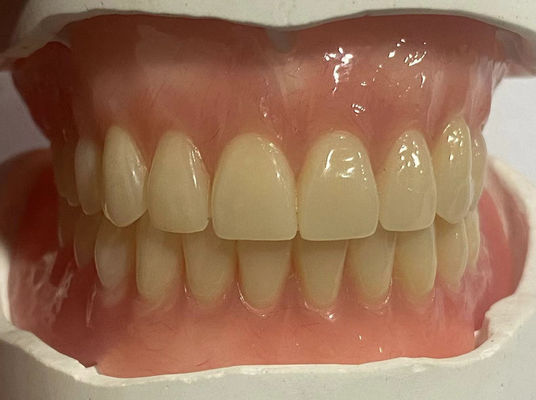 comprar Dentadura parcial extraíble hipoalergénica personalizada con color rosado de goma Fabricación en línea