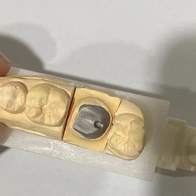Cocr Metal Post y el núcleo resistente al desgaste personalizado para una restauración eficiente