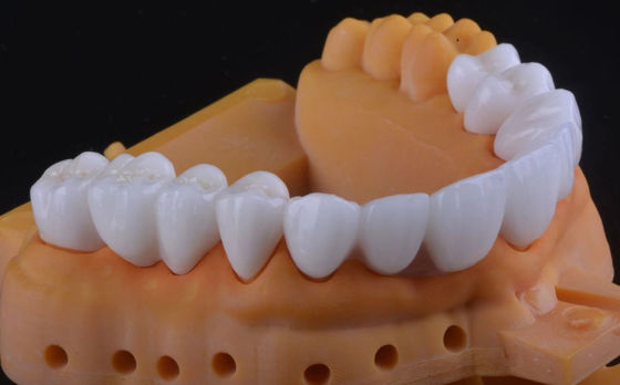 Coronilla de dientes de zirconio de alta resistencia Ultra translúcida con estabilidad a largo plazo