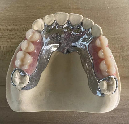Alta resistencia de fundición de metal con dentadura parcial Cocr Aolly con impresión 3D