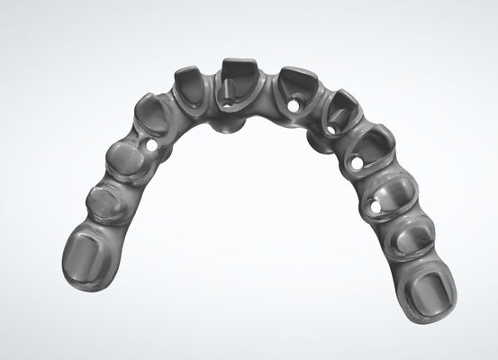 Laboratorio Dental Coronado Dental Sistemas CAD CAM personalizables para restauraciones dentales