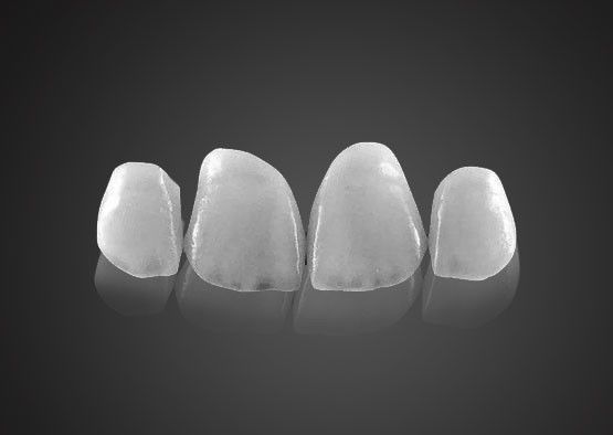 IPS 0.2mm carillas Emax ultra delgadas resistentes a las manchas con alta resistencia