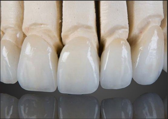 Wieland Zirconia Coronilla de cerámica interior de pintura personalizada con diseño CAD