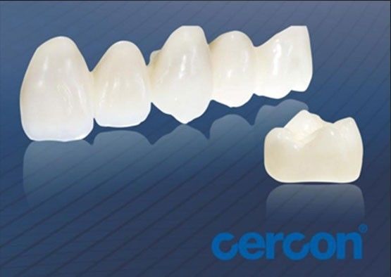 Resistencia al desgaste CAM Coronas de circón de zircón Fácil limpieza Alta biocompatibilidad