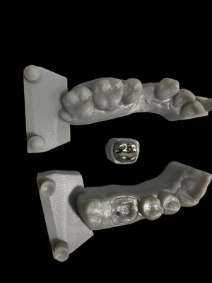 Pista de metal resistente a la corrosión y núcleo de alta adhesión para la restauración dental