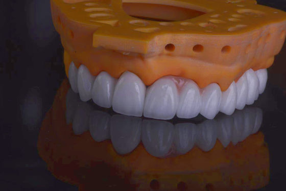 Coronas dentales de laboratorio de alta resistencia naturales para la restauración dental