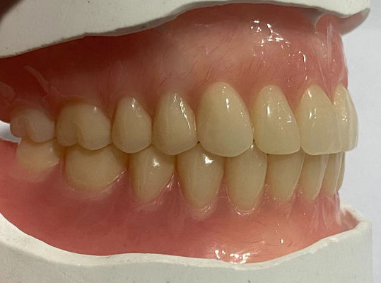 Dientes de acrílico con dentadura completa de aspecto natural para una retención óptima