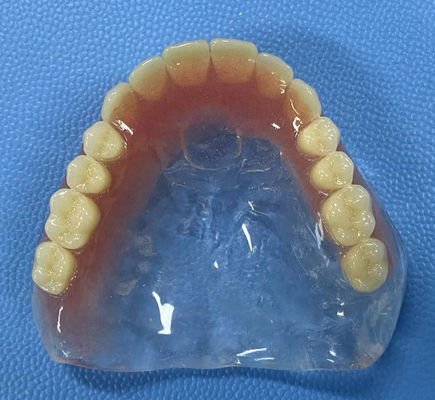 Resistencia a las manchas Dentadura acrílica completa Alta estabilidad con forma de arco completo