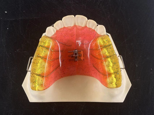 Aplicación de ortodoncia ajustable de 2 vías de expansión de arco dental