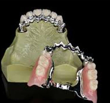 Dental de llave y llavero personalizado con alta resistencia
