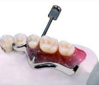 Fácil de instalar llave y llavero de la cerradura de la conexión dental resistente a la oxidación