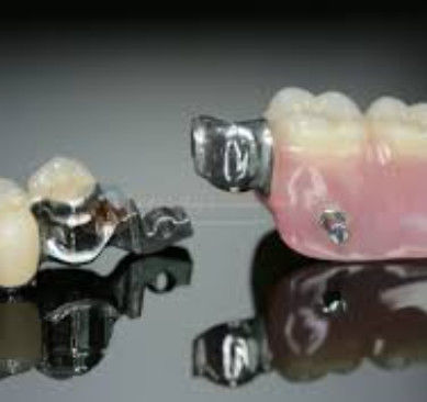 Alta flexibilidad Mk1 Apego Dental Alta precisión y seguridad de uso