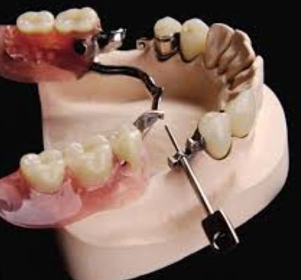 Adjustable Mk1 Apego dental resistente al agua con acero inoxidable